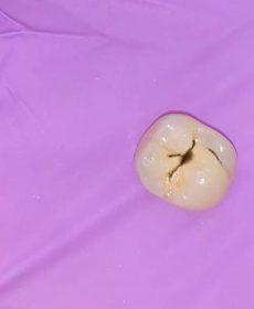 odontoterapie odontoterapie